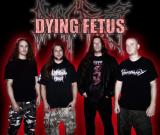 Dying Fetus - Discography (2007 - 2023) (Hi-Res) (Lossless)